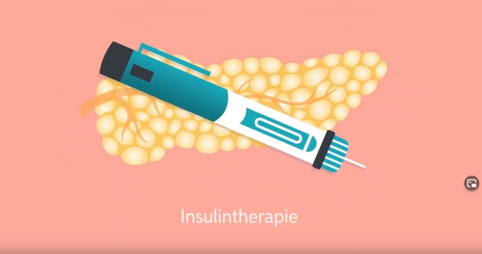 Grafik: medimotion: Wann brauche ich Insulin.