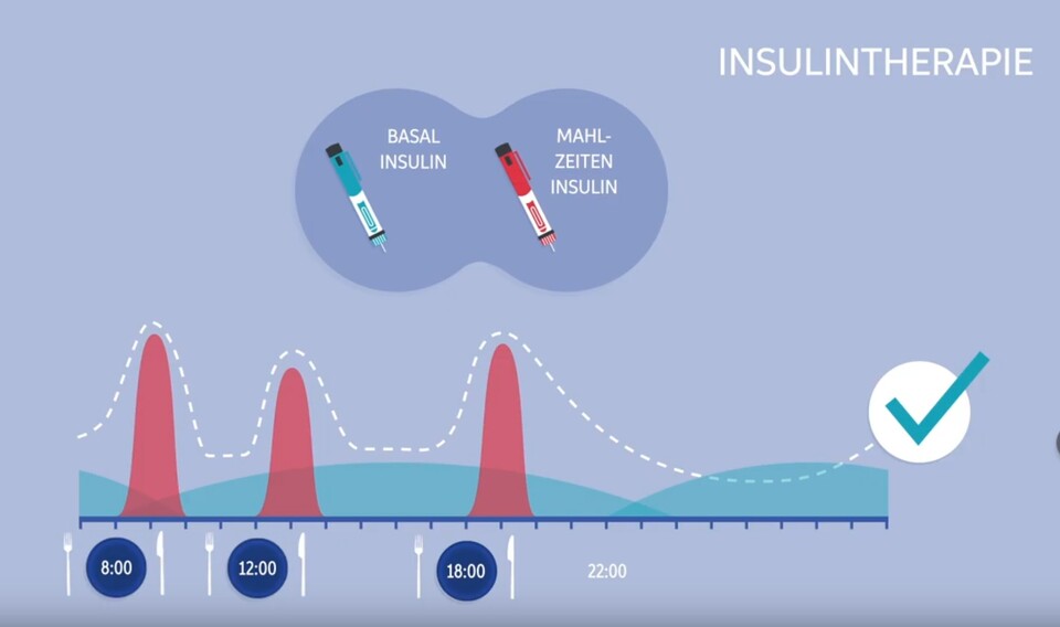 Insulinbedarf am Tag. Eine Grafik.